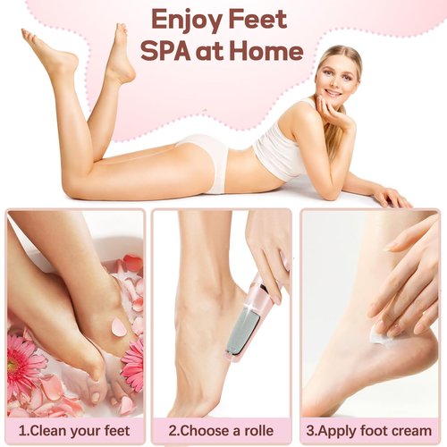 Callus Remover for Feet, ZABOUL Electric Foot Callus Remover Rechargeable Pedicure Tools Smooth Pedicure Wand Electronic Foot File, Feet Care for Removes Dry Hard & Dead Skin Ideal Gift