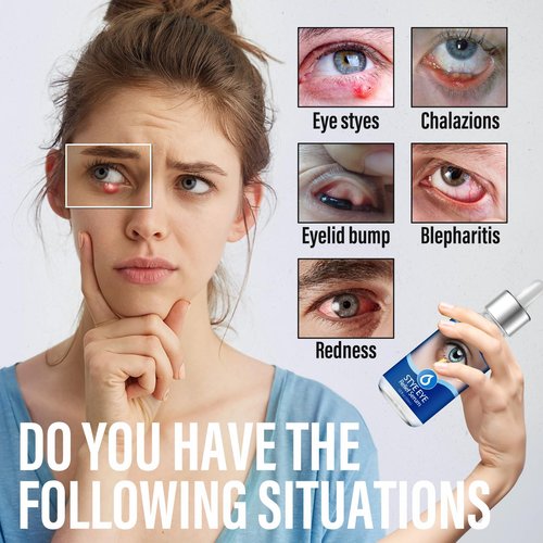 Stye Eye Treatment, Eye Stye Relief Serum, Natural & Gentle Stye Cure, Non-Irritating Formula, Target Chalazions & Blepharitis (1 Fl Oz (Pack of 1))