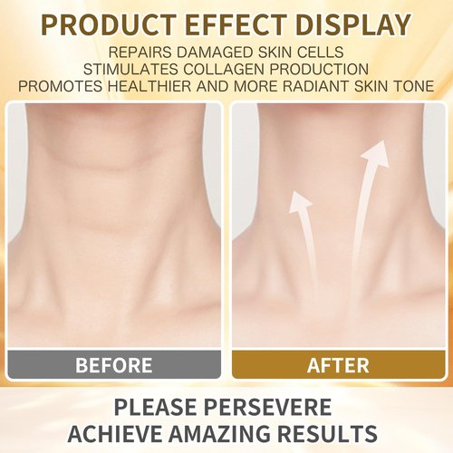 Anti Aging Firming Neck Cream, 5-IN-1 Face Tighten and Lift Neck Cream, Anti Wrinkle Neck Retinol & Collagen Cream, Chest Neck & Face Lifting|Repairing|Moisturzing Skin Care for Men & Women - New