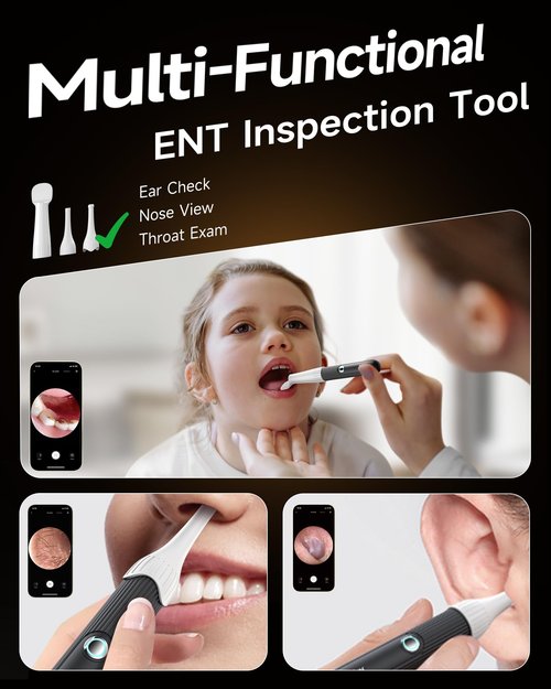 Anyear Flexible Ear Wax Removal Tool Camera, Wireless Ear Cleaner with 10MP HD Otoscope, Painless Tweezers, 12 Soft Tips, 3 Inspection Heads, Portable Earwax Removal Kit with Camera for Adults/Kids