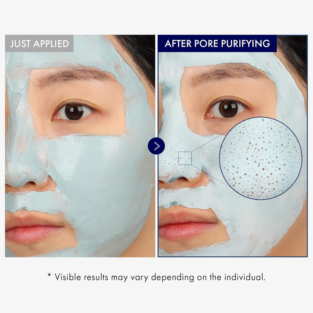 TOSOWOONG Real Blackhead Mud Mask - Pore-Purifying Clay for Deep Cleaning & Oil Control | 100g / 3.52oz