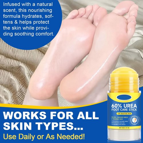60% Urea Foot Cream Stick with 2% Salicylic Acid, Extra-Strength Cracked Heel Repair for Dry Feet & Calluses, Moisturizing Urea Cream Stick for Dead Skin Removal, Heel Balm for Rough Skin(2pcs)