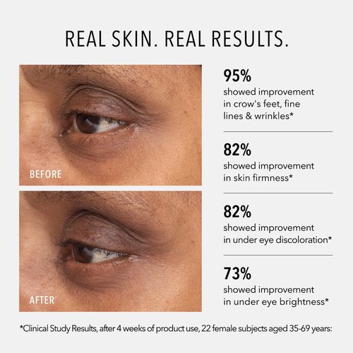 HydroPeptide Retinol Eye Renewal Balm - Lifting & Firming with Tri-Retinol Complex, 0.5 Oz