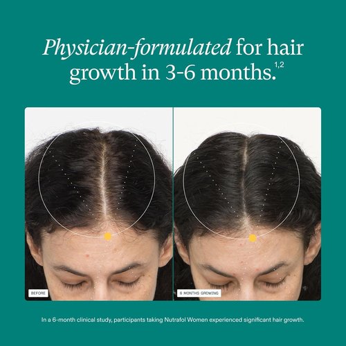 Nutrafol Women's Hair Growth Supplements - Clinically Proven for Thicker, Stronger Hair | 1 Month Supply (Ages 18-44)