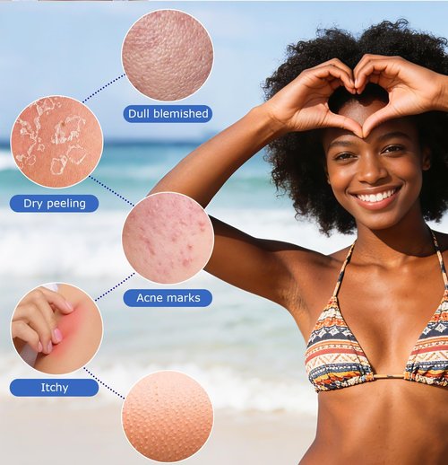 UJFQBH African Net Sponge 2-Pieces, Authentic Exfoliating Body Scrubber for Shower & Bath, Deep Cleansing Lather for Dead Skin Removal, Back Scrubber for Women & Men (Rose Red & Purple)