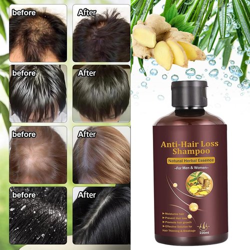 Skiennix Hair Growth Shampoo - Anti-Thinning Formula for Fast Hair Growth | 220ML for Men & Women