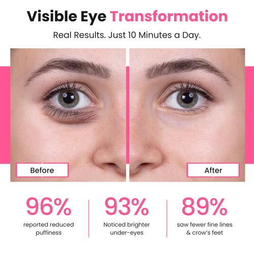 Bèa Eye Revitalize – Red Light Therapy for Dark Circles & Eye Bags