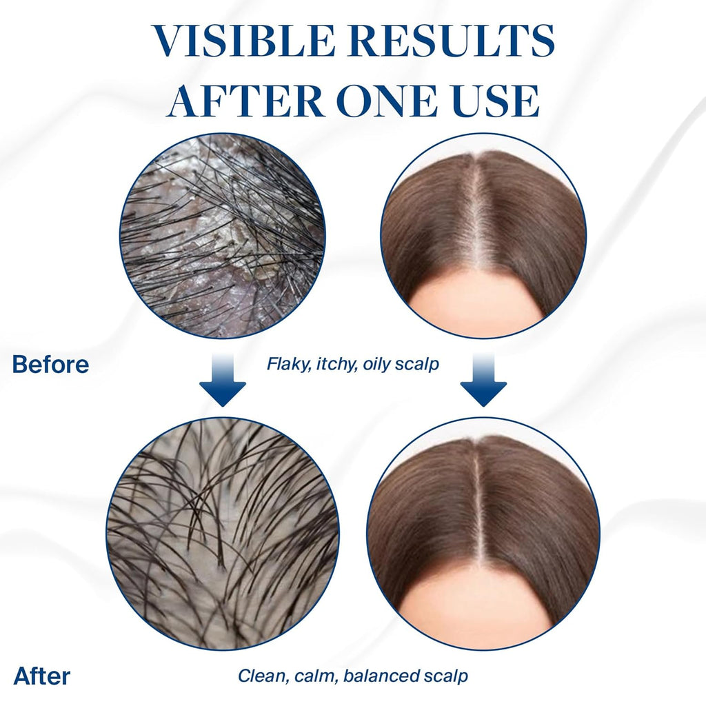 Voir Haircare Scalp Serum - Hydrating & Calming Formula for Dry, Itchy Scalp | 30ml with Canadian Glacial Oceanic Clay