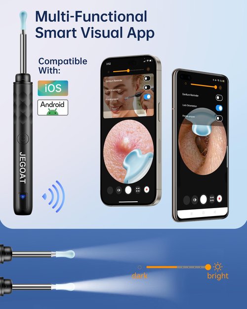 Jegoat Ear Wax Removal, Ear Wax Removal Tool Camera with 1296P HD Camera and 6 LED Lights, Ear Cleaner with 10 Ear Pick, Upgraded Ear Wax Removal Kit for iOS and Android, Black