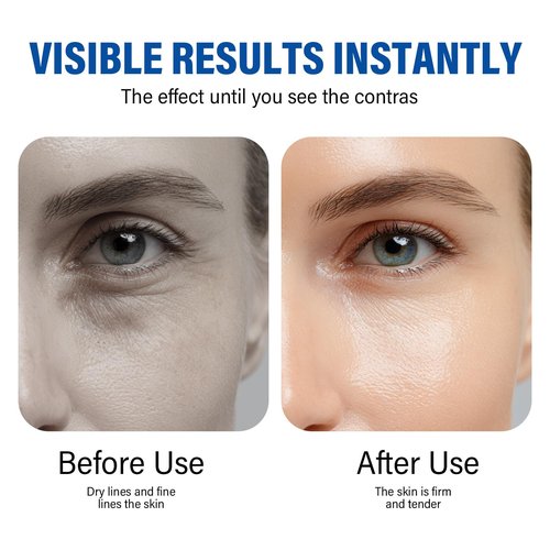 ITECFREELY Instant Eye Tightener, Perfection Eye Tightener Cream for Under Eye Bags & Fine Lines, Hydrating & Non-Greasy, Easy-Wear for All Skin Types