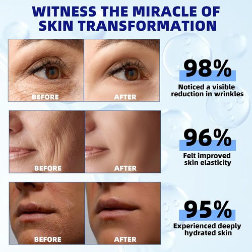 Skiennix Retinol Serum - 2.5% Intense Night Formula with Squalane, Vitamin C & E | 30 ml for Youthful Skin