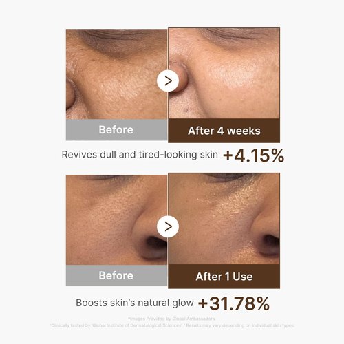 medicube Deep Vitamin C Capsule Serum | Hydrating Vitamin C Serum for Dull & Uneven-Looking Skin with Visible Concerns | Liposome Capsules for Smooth, Radiant Texture | Korean Skincare 1.01 fl.oz