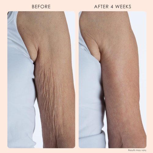 Crepe Erase BODY FIRM 2-Step Anti-Aging Treatment - Firming Moisturizer & Exfoliating Pre-Treatment for Wrinkle Reduction
