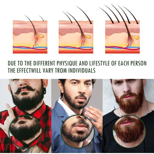 Apolo Para Barba, Estimulante Para Barba Ultra Potente, Bálsamo Para Crecimiento de Barba Para Hombre, Apolo Para Cabello Barba Crema, Beard Beard Growth Oil Stimulating Balm Thicker, Fuller (2pcs)