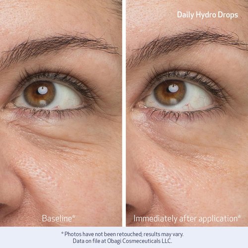 Obagi Daily Hydro-Drops Facial Serum & Rejuvenating Eye Gel Cream Set - 1oz Serum Hydrates & Softens Wrinkles | .5oz Eye Cream Brightens & Depuffs