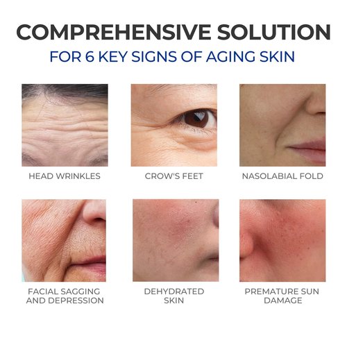SKINERSE Retinol Serum for Face, Anti Aging Serum, Retinoid Collagen with Vitamin E Resurfacing Facial Rapid Fine Lines Repair, Brightening Pore Minimizer for Face Daily Skin Care Treatment 1oz