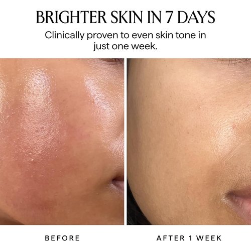 HERBIVORE Nova 15% Vitamin C Serum - Brightening Turmeric Formula for Dark Spots | Vegan, 30 mL / 1 oz