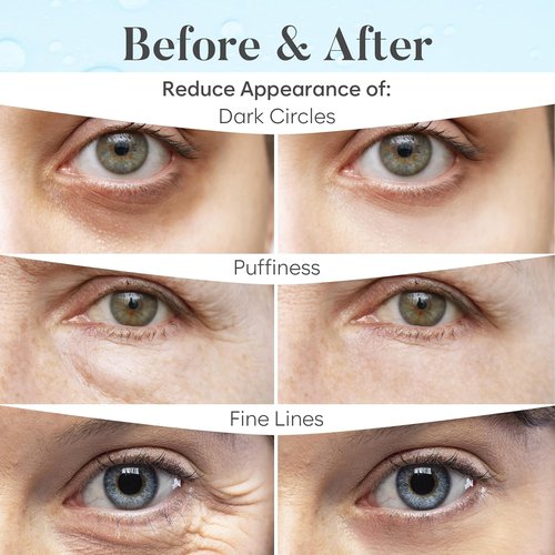 BLOOMORA Marine Collagen Under Eye Patches - Hydrating Mask for Puffy Eyes & Dark Circles | 30 Pairs