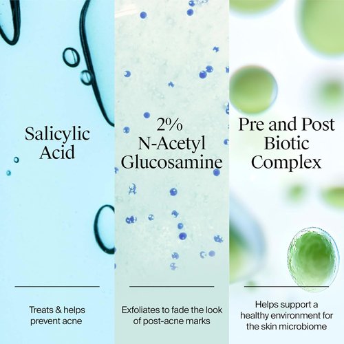 Neutrogena Evenly Clear Acne Gel Moisturizer - Lightweight Salicylic Acid Formula for Breakout Treatment | 1.7 fl. oz