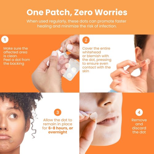 Patchology Not A Spot Hydrocolloid Pimple Patches – 48 Clear Acne Stickers for Face and Body – Skin-Friendly Spot Treatment for Whiteheads, Blemishes, and Breakouts – Invisible and Travel-Friendly