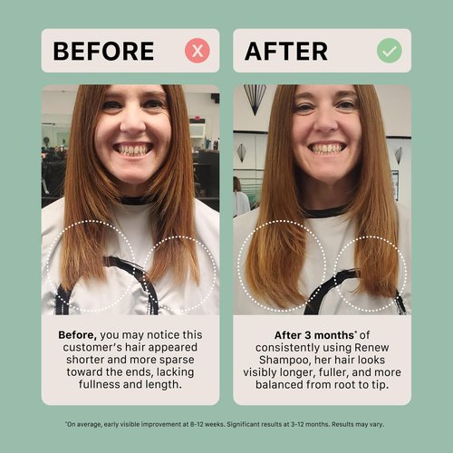 ACTIIV Renew Travel Duo | Supports Scalp Health & Appearance of Fuller, Healthier-Looking Hair, Hydrates & Nourishes, Heals Damaged & Over-Processed Hair, Plant-Based, Color-Safe, Vegan