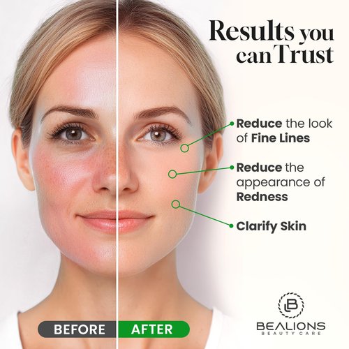 Bealions Castor Oil Roll On for Face: Castor Oil with Rose Quartz Roller for Massage - Deep Hydration Skin Moisturizer - Birthday Valentine Gifts for Women 35-65 (1.7 FL. OZ.)