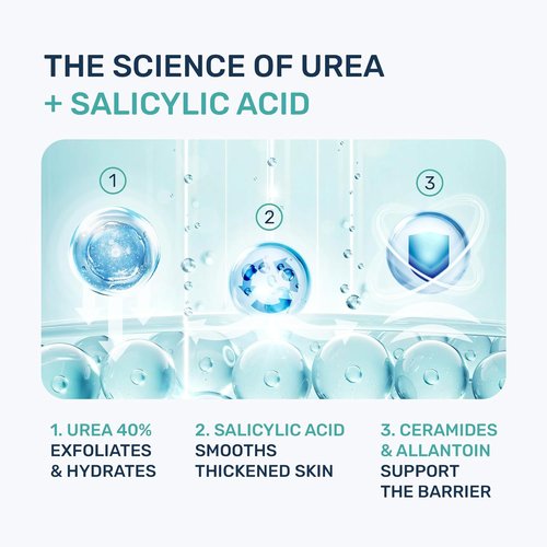 Urea Cream 40% - Maximum Strength Callus Remover Foot Cream for Dry Cracked Heels | 4.3 oz