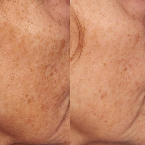 Regine Switzerland Vitamin C Ester Dark Spot Treatment - Intensive Formula, 1 fl. oz.