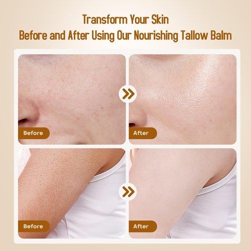 Hicream Beef Tallow for Skin, Beef Tallow and Honey Balm, 100% Organic Grass-Fed Beef Tallow Balm, Face & Body Moisturizer, Deeply Nourishment for Dry, Cracked, Sensitive Skin, Natural Formula (4 Oz)