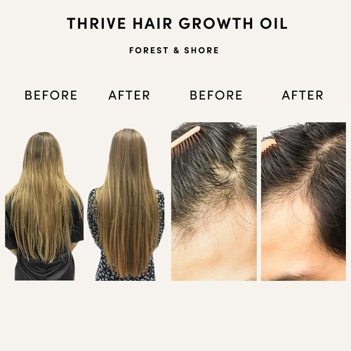 Forest & Shore Hair Growth Oil - 100% Natural Serum with Caffeine, Biotin & Argan for Damaged Hair