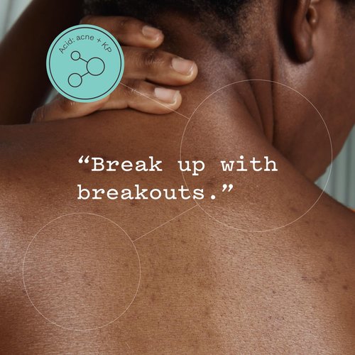 Frank Body Glycolic Acid Body Scrub - Fights KP, Breakouts & Tightens Pores | 8.82 oz | Soothes with Witch Hazel
