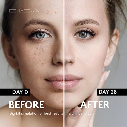 EnaSkin Dark Spot Remover Serum - Advanced Niacinamide Formula for Face & Body (1.0 Fl Oz)