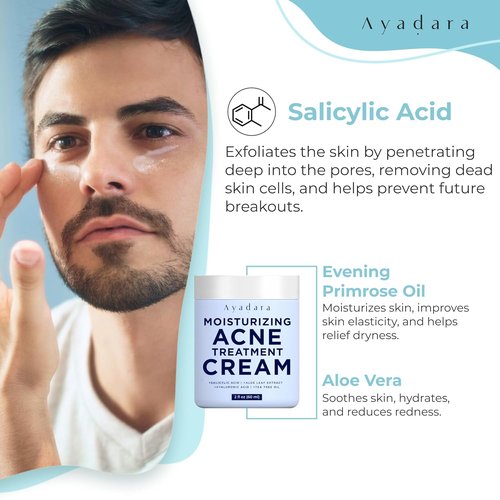 Ayadara Acne Cream - Moisturizing Salicylic Acid Face Moisturizer for Oily Skin | 90-Day Supply