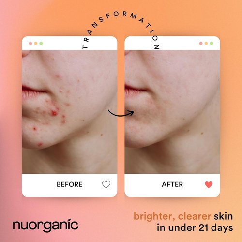 Nuorganic Turmeric Face Mask - Soothing & Acne Clearing Formula | Airtight Tube for Freshness Up to 12 Months