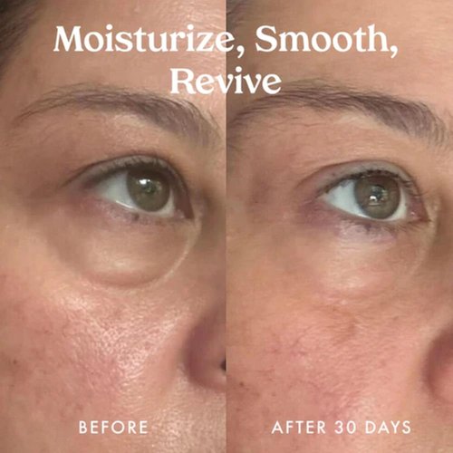 Kopari Ceramide & Retinol Eye Balm - Hydrating Anti-Aging Treatment for Fine Lines & Puffiness with Squalane