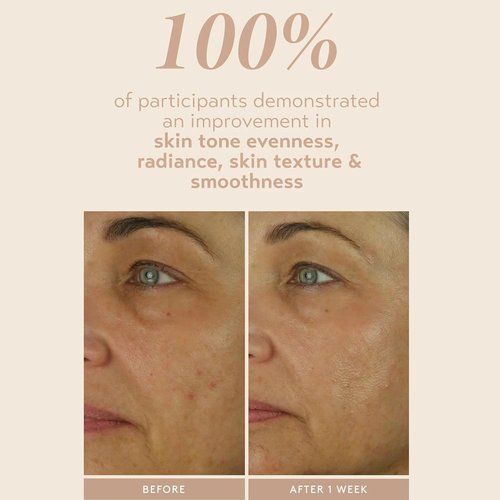 SHANI DARDEN SKIN CARE Retinol Reform Serum - 1% Encapsulated Retinol for Youthful Skin, 1 fl oz