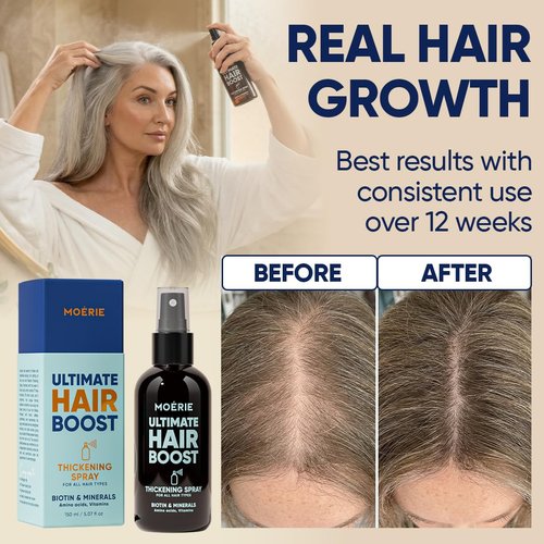 Moerie Hair Growth Serum Spray - Biotin & Rosemary Formula for Thinning Hair | Scalp Care Solution