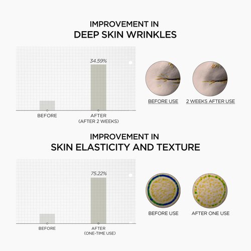 SKIN1004 Retinol 0.2% Boosting Shot Ampoule, Valentine Gifts, Hydrating Face Serum, Korean Facial Spicule Serum, Retinol & Retinal, Madagascar Centella Asiatica, Korean Skin Care, 1.01fl.oz / 30ml