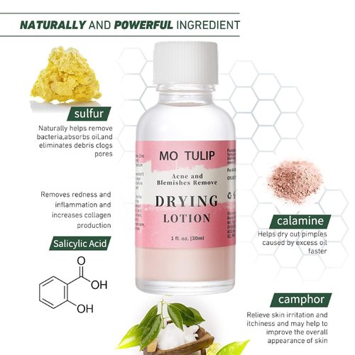 MO TULIP Acne Drying Lotion - Overnight Spot Treatment for Face & Body, 1oz Pimple & Blemish Solution