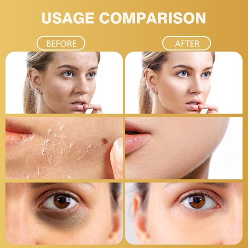 Bee Venom Skin Treatment Cream - Anti Aging Moisturizer with Collagen Boost & Skin Brightening, Bee Venom Sensitive Skin Tightening Care Day & Night Use 2.12 OZ