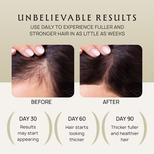 Lebanta Hair Growth Oil Spray - 100% Pure Organic Formula for Thicker, Stronger Hair - 4.1 Fl Oz