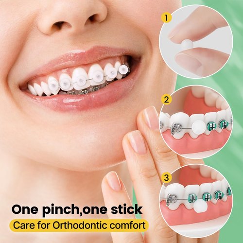 Orthodontic Wax for Braces - 240 Dots, Individually Wrapped Dental Wax, Relieves Pain from Braces & Other Orthodontic Appliances, Mint