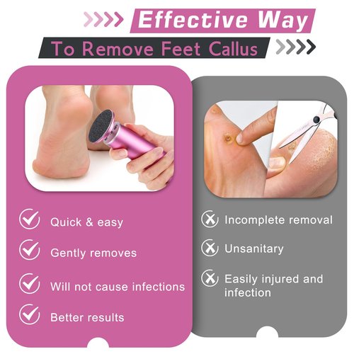 Electric Callus Remover, Foot Nail File Grinder Tool with Speed Controller and 60PCS Replacement Sandpaper Disk, Pedicure Tool Feet Scrubber for Dead Dry Crack Skin Calluses