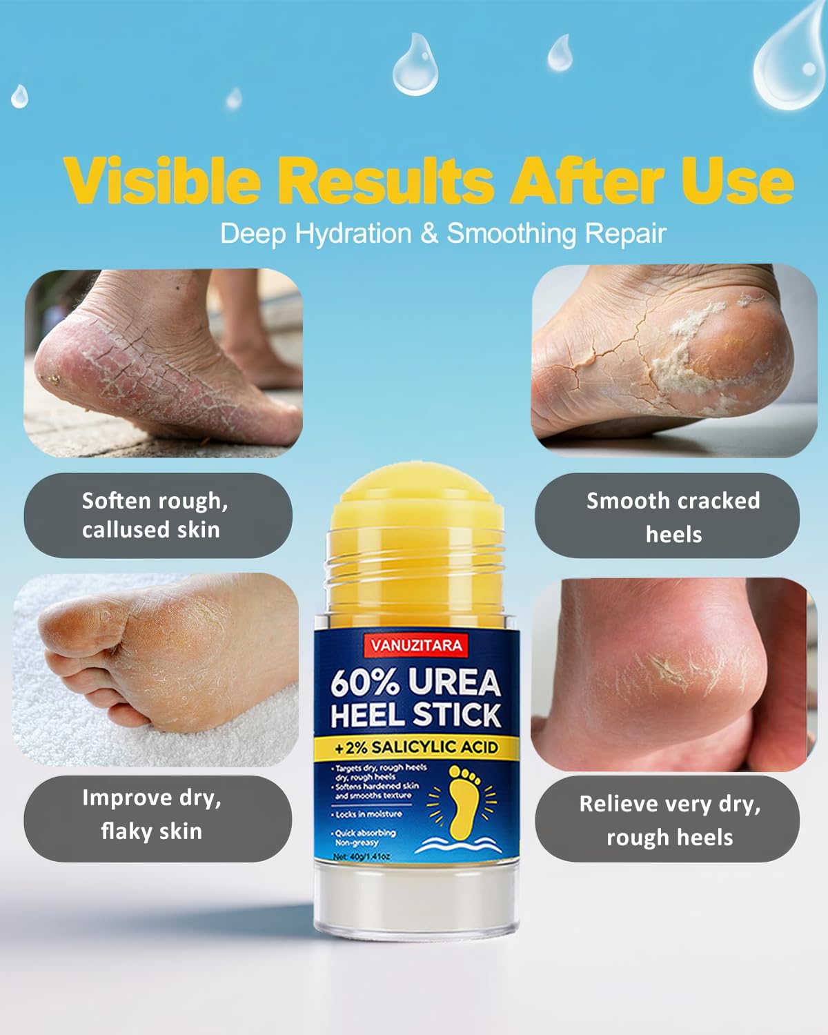 Urea Cream 60% by [Brand Name] - Maximum Strength Foot & Hand Cream with 2% Salicylic Acid | 1.41oz
