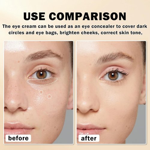 Skiennix Mineral Sunscreen Eye Cream - 3-in-1 Under Eye Treatment for Puffiness & Dark Circles | SPF 35 (Light)