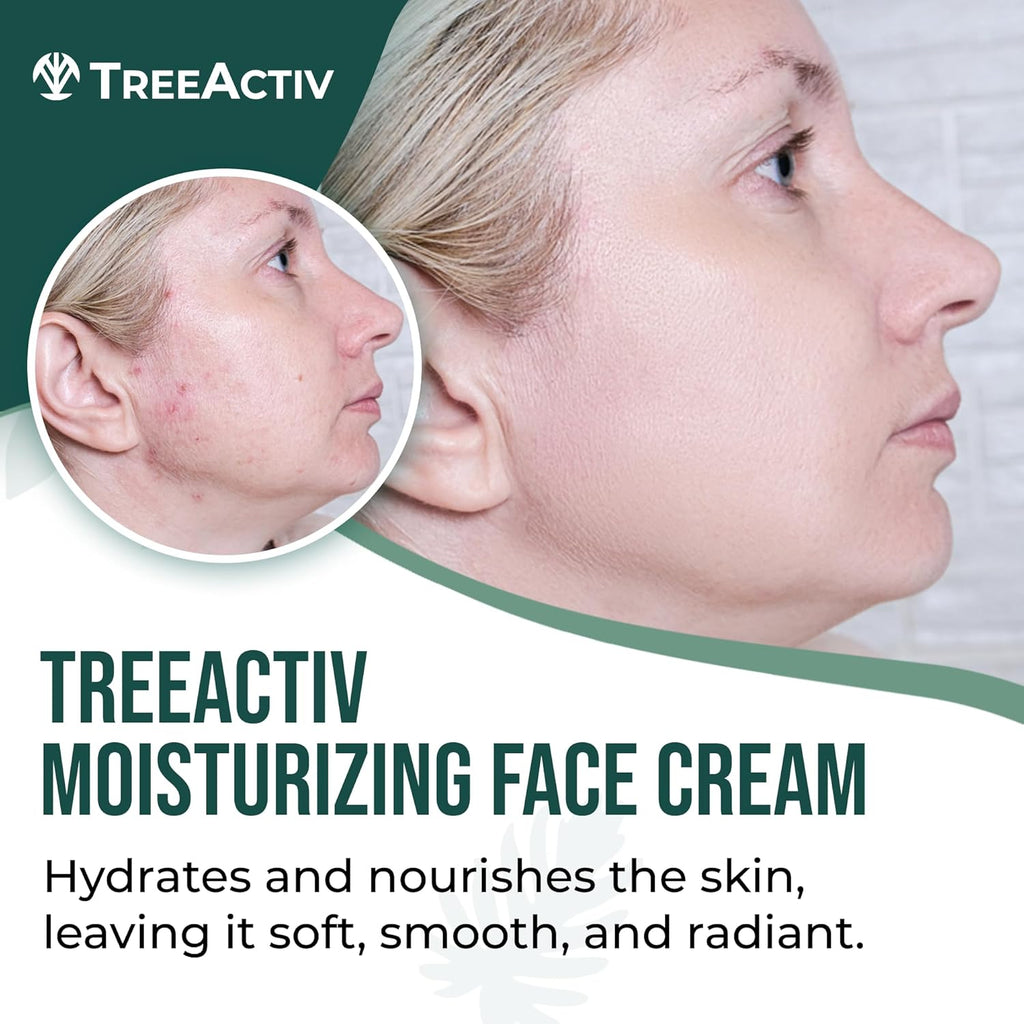 TreeActiv Acne Eliminating Face Cream - Moisturizing Tea Tree Formula for Balanced Skin | 2 fl oz