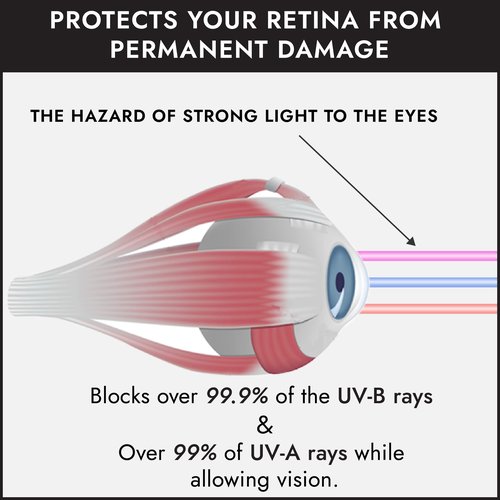 Super Sunnies UV Eye Protection FDA Compliant Eyeshields, Tanning Bed Goggles, Red Light Theraphy Glasses with Strap - 12 Pack Black/Red/White
