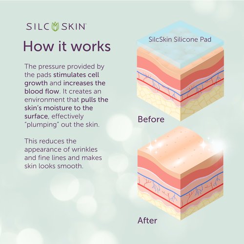 Silc Skin Silicone Eye Pads Reusable Overnight Eye Patches, Medical Grade Silicone For Fine Lines And Puffiness, Eye Mask Holiday Beauty Gift For Her, 60 Day Supply