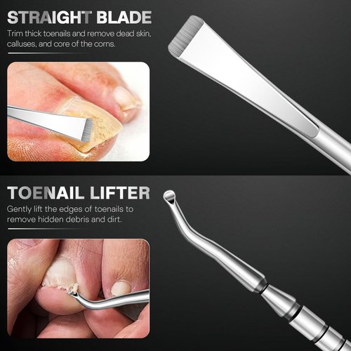 6PCS Ingrown Toenail Treatment Set, Professional Pedicure Tools for Feet, Ingrown Toenail Removal Kit with Leather Case Foot Nail Care Tools Manicure Set for Ingrown Toenails Calluses Corn & Dead Skin