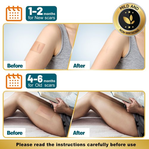 Aheroi Silicone Scar Tape, 1.6"x200" Silicone Scar Sheets(2 Rolls-5M)Medical Grade Scar Sheets for Surgical Scars, Soft Scar Patches Reusable Scar Removal Strips,Effective C-Section Keloid Tummy Treat